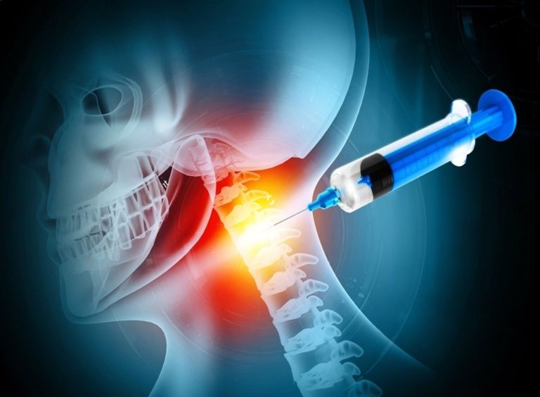 Cervical Spine Surgery
