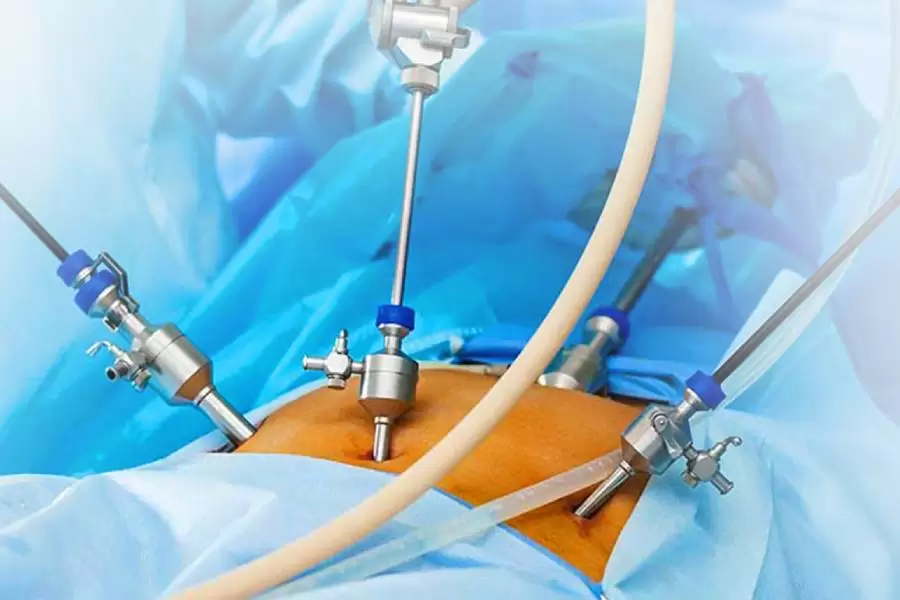 Diagnostic Laparoscopy (for abdominal pain, cancers)