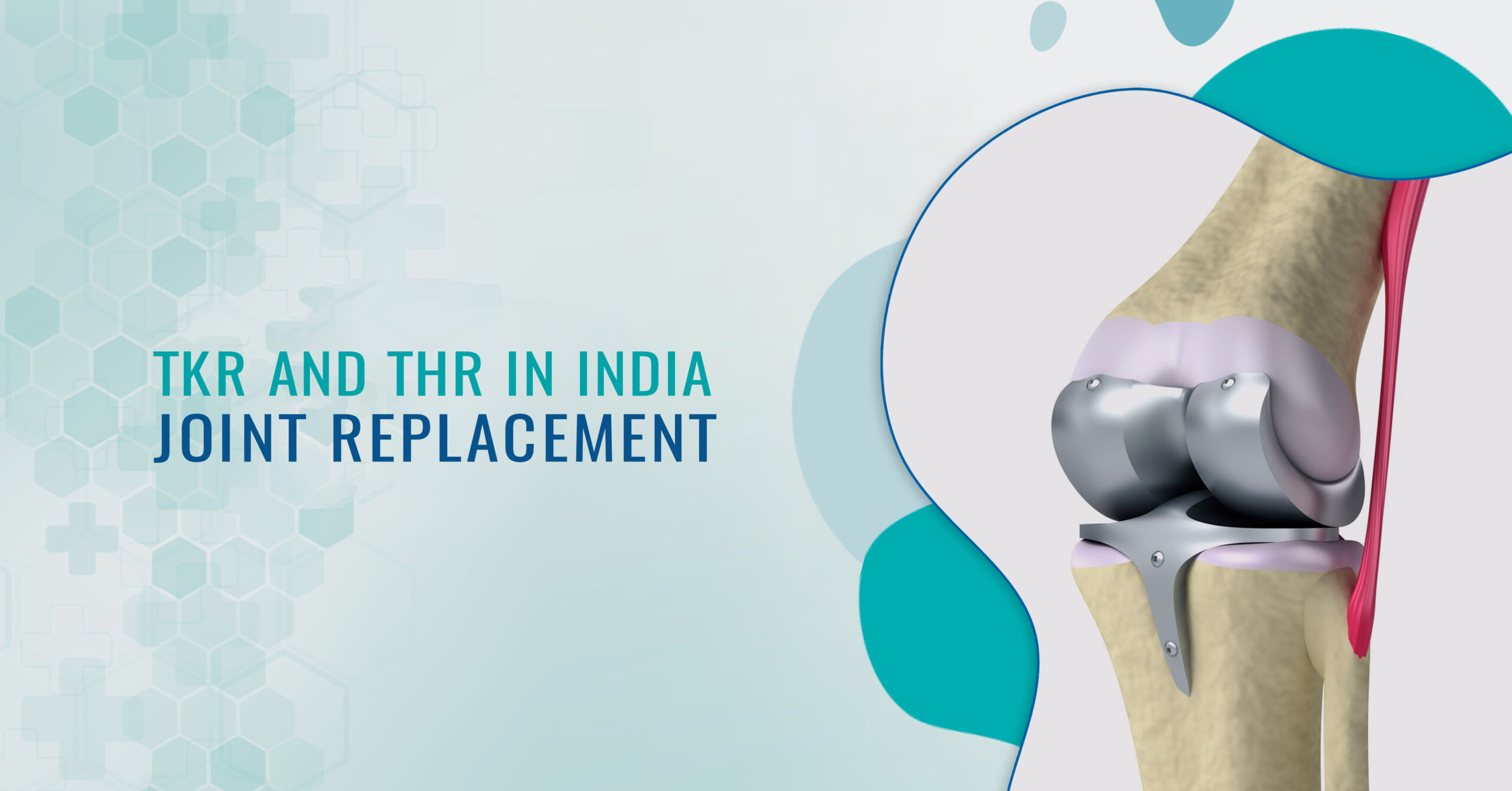 Joint replacement surgeries (THR & TKR)
