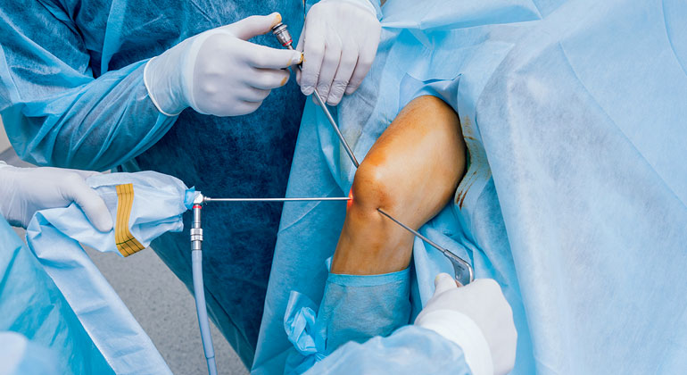 Knee & Shoulder Arthroscopy