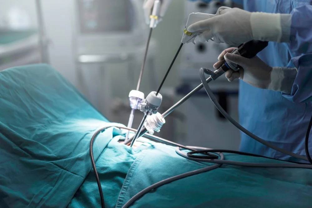 Laparoscopic (Minimal Access) Surgeries
