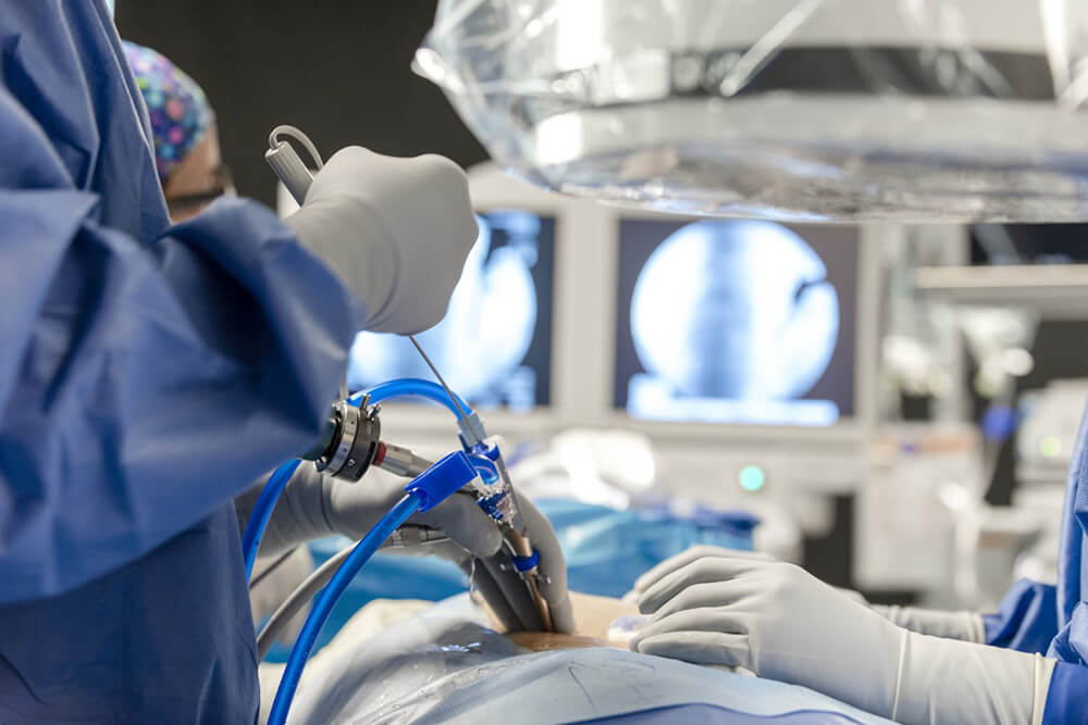 MISS TLIF, endoscopic discectomy, tubular decompressions