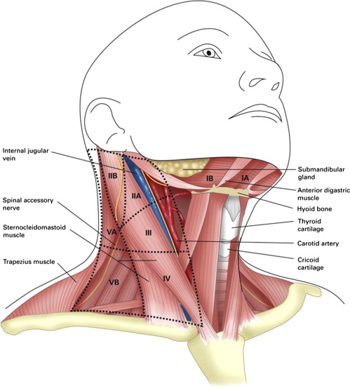 Neck dissection for thyroid malignancy
