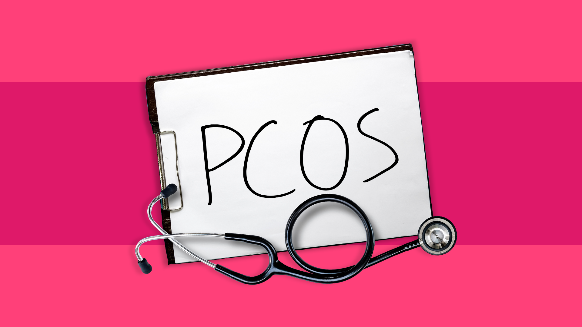 Ovarian Drilling (For clomiphene-resistant PCOS)
