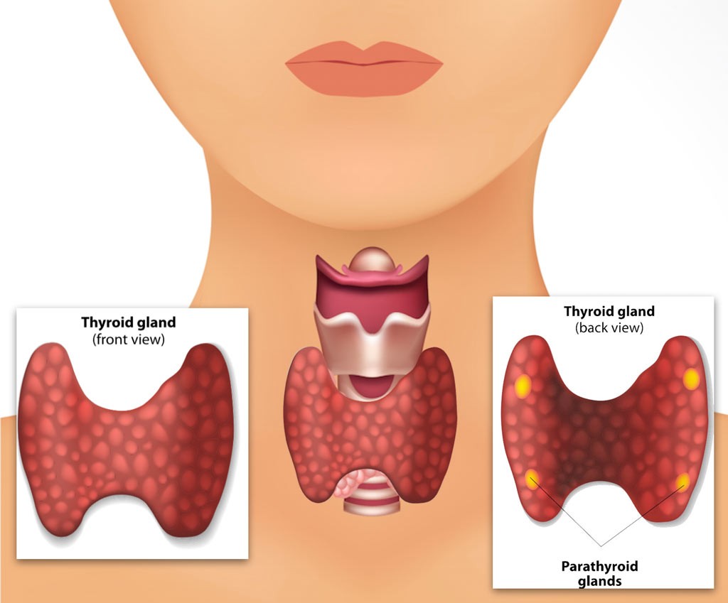 Parathyroidectomy (for hyperparathyroidism)
