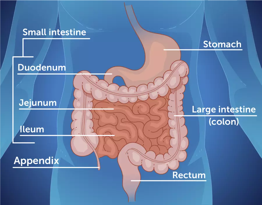 Small Bowel Resection (for obstruction, perforation, Crohn’s)