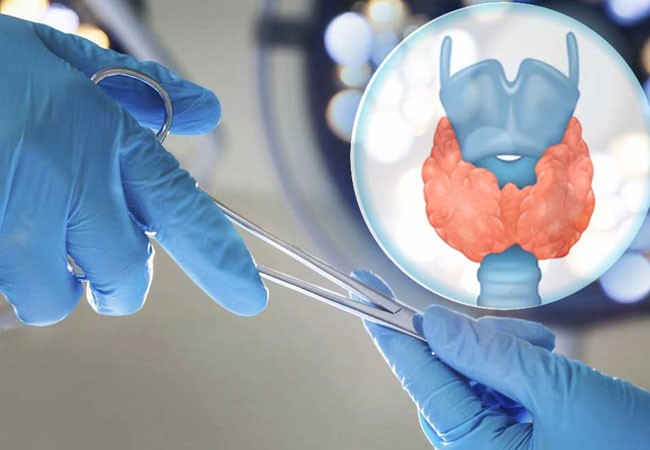 Thyroid and Endocrine Surgeries
