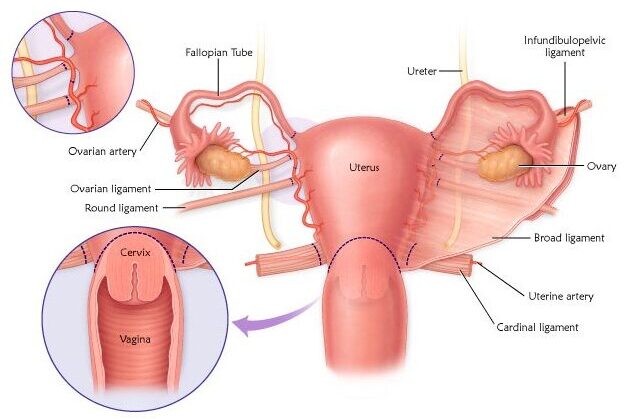 Vaginal Hysterectomy